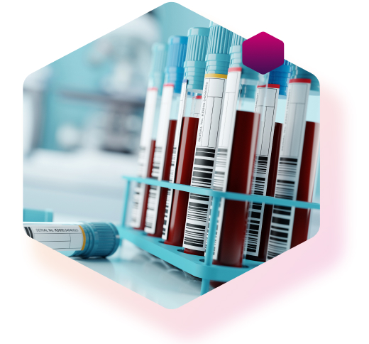 Blutzuckertest in Reagenzgläsern für die Diabets-Typbestimmung Blutzuckertest in Reagenzgläsern für die Diabets-Typbestimmung