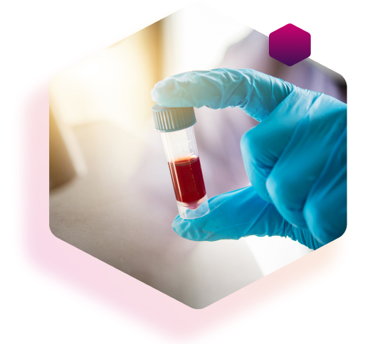 Laborassistent misst Langzeitblutzuckerwert (HbA1c-Wert)