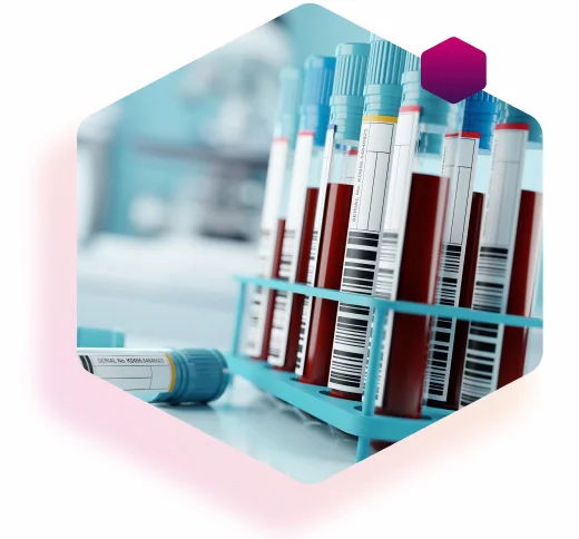 Blutzuckertest in Reagenzgläsern für die Diabets-Typbestimmung Blutzuckertest in Reagenzgläsern für die Diabets-Typbestimmung